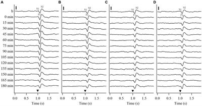 Rapidly repeated visual stimulation induces long-term potentiation of VEPs and increased content of membrane AMPA and NMDA receptors in the V1 cortex of cats